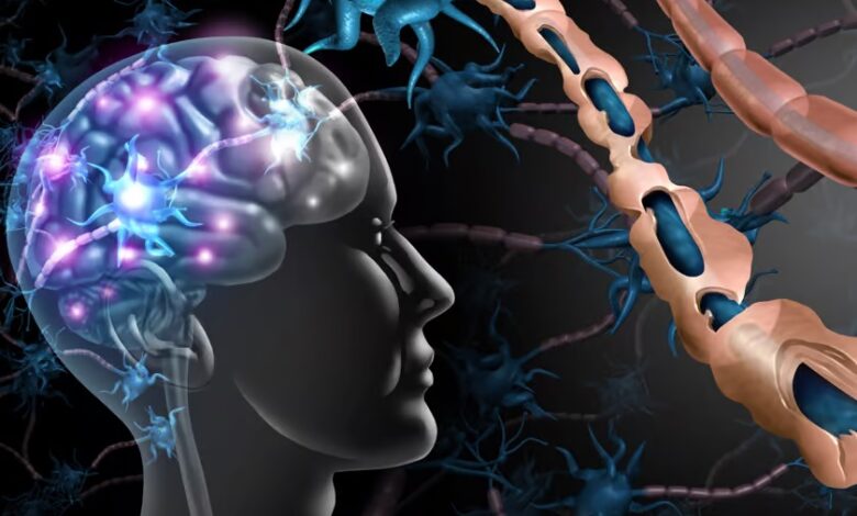 تقویت اعصاب علائم ام اس را کاهش می دهد