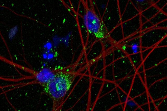 مدل‌سازی جدیدی از نورون‌های انسانی منجر به شناسایی اهداف درمانی جدیدی شده...